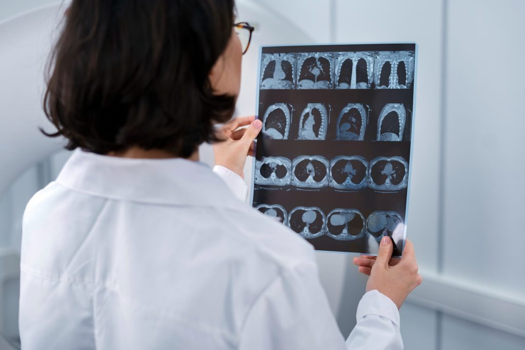 Does Xanax Cause Dementia - Alt Text